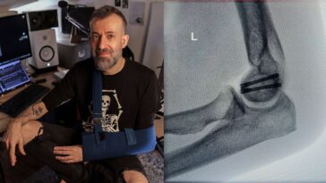Jon Gomm Discusses the Stage Incident That Halted His Guitar Playing]