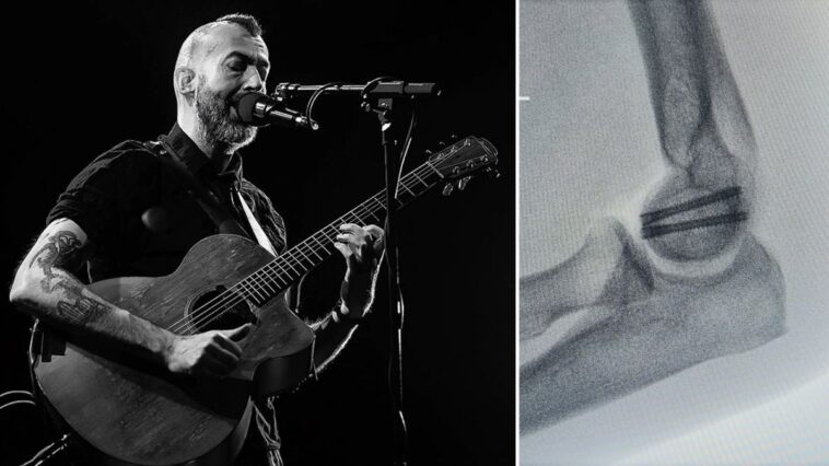 Jon Gomm's terrifying accident that nearly cut his career short]