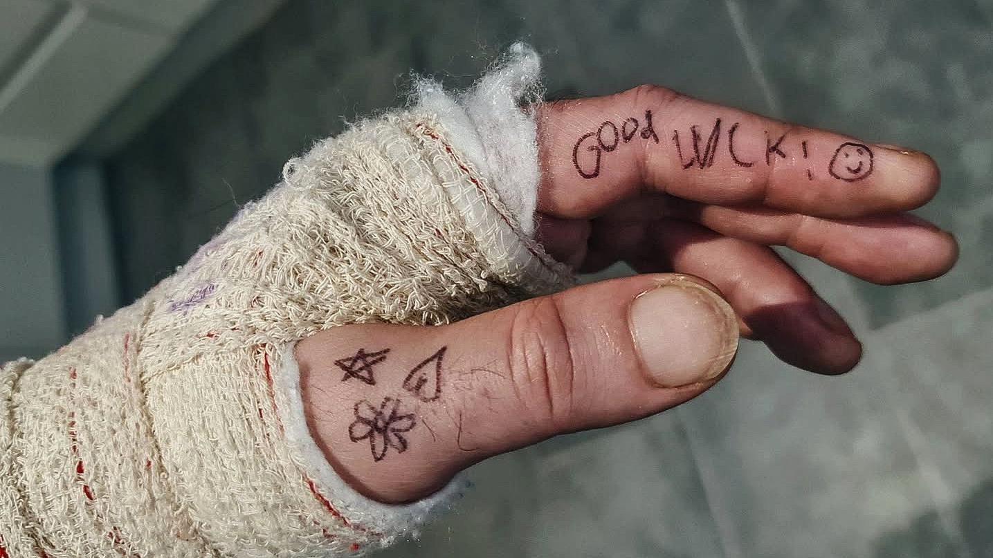 Acoustic guitarist Jon Gomm's hand in a cast following his fall from a stage on February 5, 2026. His hand features a flower, star and heart and the greeting "Good luck!" with a smiley face, all written in black pen