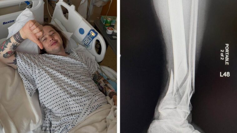 Billy Strings Injured in Skateboarding Accident, Tour Dates Delayed]