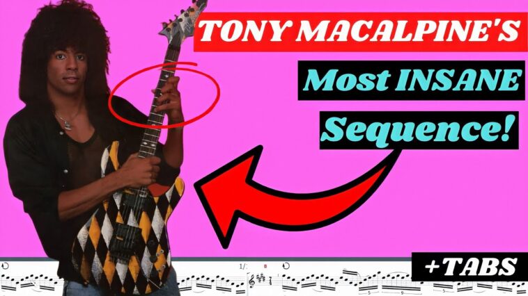 Tony MacAlpine