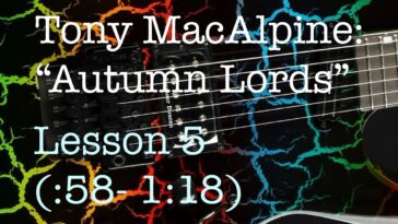 Tony MacAlpine