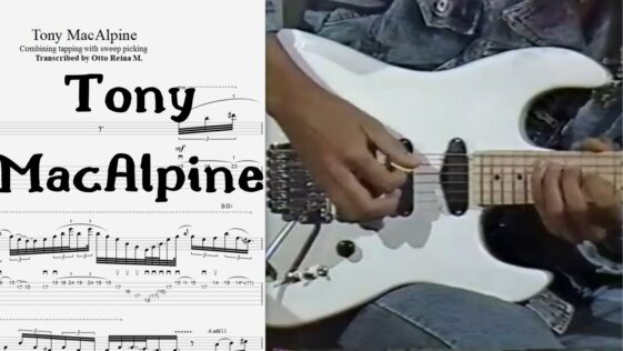 Tony MacAlpine